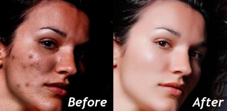 What Is Photo Retouching